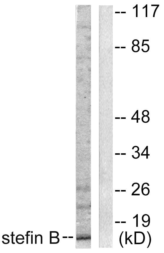 CSTB / Cystatin B / Stefin B Antibody