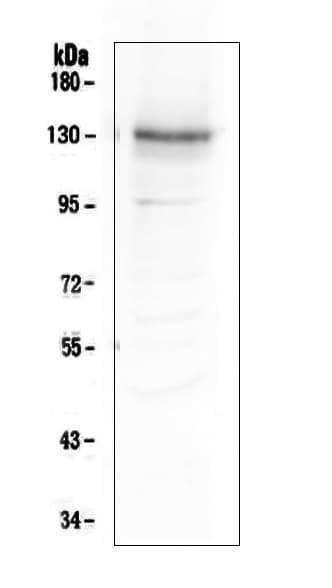 Polyclonal Rabbit anti-Human ITGA3 / CD49c Antibody (IHC, WB)