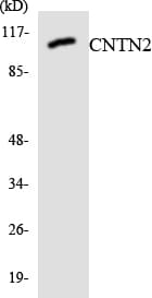 CNTN2 / TAX Antibody (aa98-147)