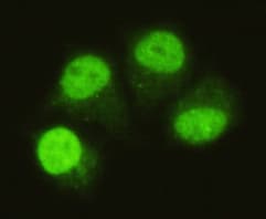 IHC-plus™ SMAD5 Antibody (C-Terminus, clone 4B10-B10-B6)