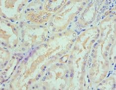 Polyclonal Rabbit anti-Human SPTLC1 / HSN1 Antibody (aa37-310, IHC, WB)