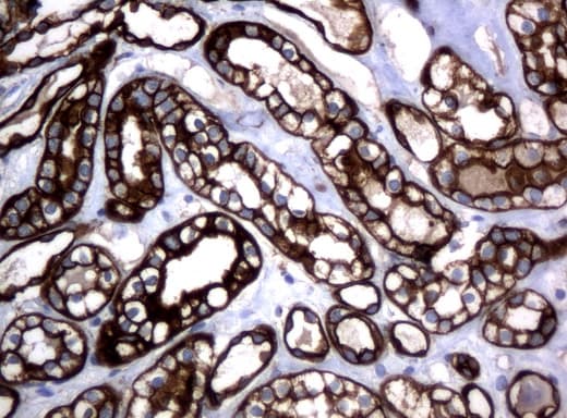 Monoclonal Mouse anti-Human KRT18 / CK18 / Cytokeratin 18 Antibody (clone UMAB50, Carrier-free, aa69-372, IHC, IF, WB)