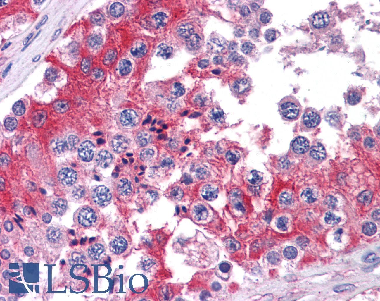 IHC-plus™ Polyclonal Goat anti-Human COMT Antibody (aa170-183, IHC, WB)