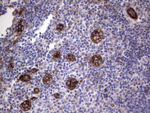 MCAM / CD146 Antibody (clone UMAB155)