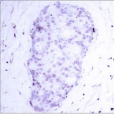 NFKB1 / NF-Kappa-B Antibody