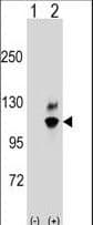 Polyclonal Rabbit anti-Human GNL2 Antibody (aa18-45, WB)