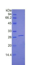 Human PAPPA2 / Pappalysin 2 Protein (Recombinant His)