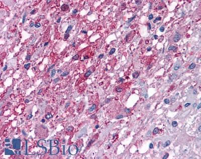 PathPlus™ Polyclonal Rabbit anti-Human HRH1 / Histamine H1 Receptor Antibody (Extracellular Domain, IHC)