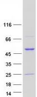 Human RCC1 Protein (Recombinant Myc-DDK (Flag))