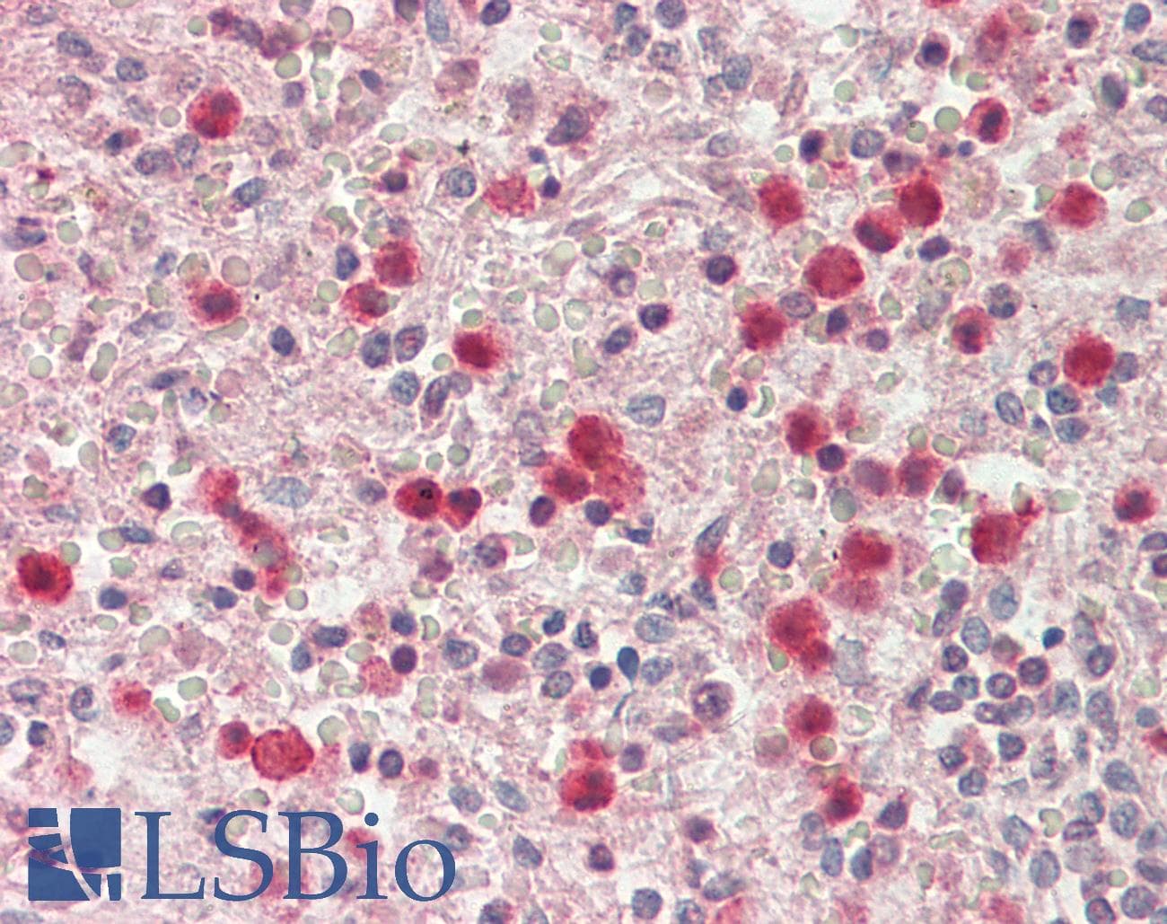 IHC-plus™ SERPINB1 Antibody (aa65-80)