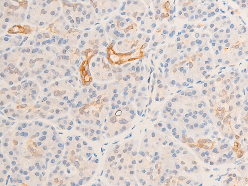 GSK3B / GSK3 Beta Antibody (phospho-Ser9)