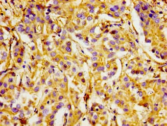 ITGA1/CD49a/Integrin Alpha 1 Antibody