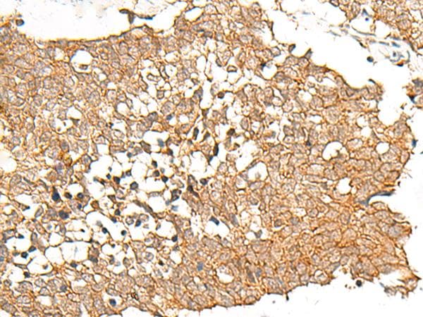 PRLHR / GPR10 Antibody