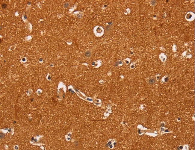 CD30 Antibody