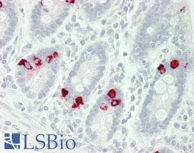 IHC-plus™ CHGA / Chromogranin A Antibody (aa376-404)