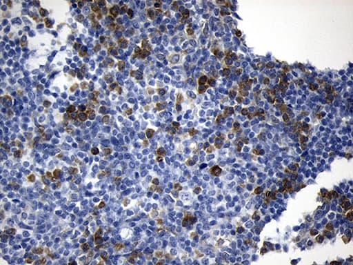Monoclonal Mouse anti-Human NAF-1 / CISD2 Antibody (clone OTI4F8, IHC, WB)