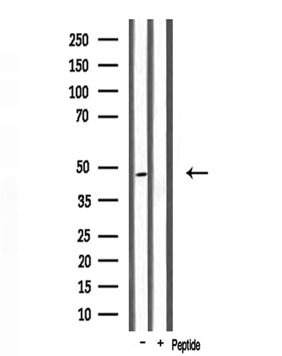 ABHD2 Antibody
