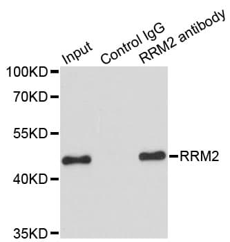 Polyclonal Rabbit anti-Human RRM2 Antibody (IHC, IF, WB)