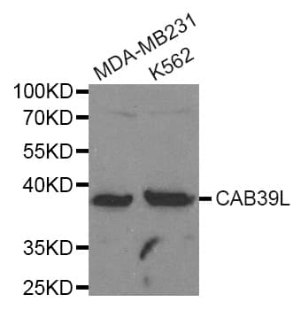 CAB39L Antibody