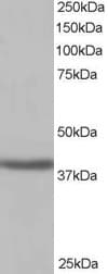IHC-plus™ Polyclonal Goat anti-Human SIRT4 / Sirtuin 4 Antibody (aa302-314, IHC, WB)