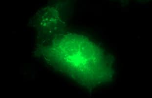 CLDN6 / Claudin 6 Antibody (clone OTI4B6)