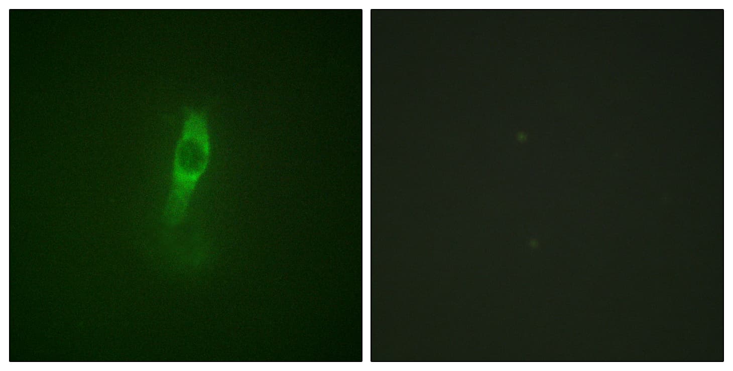 ETK / BMX Antibody (phospho-Tyr40)