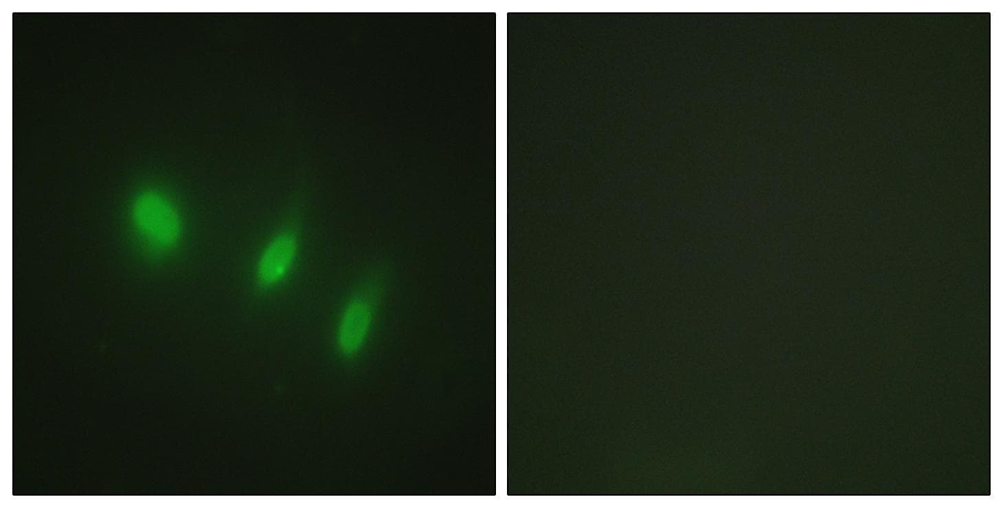 FOXO4 / AFX1 Antibody (p451)
