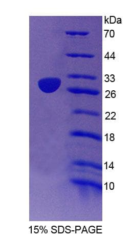 Mouse EMILIN2 Protein (Recombinant His-T7)
