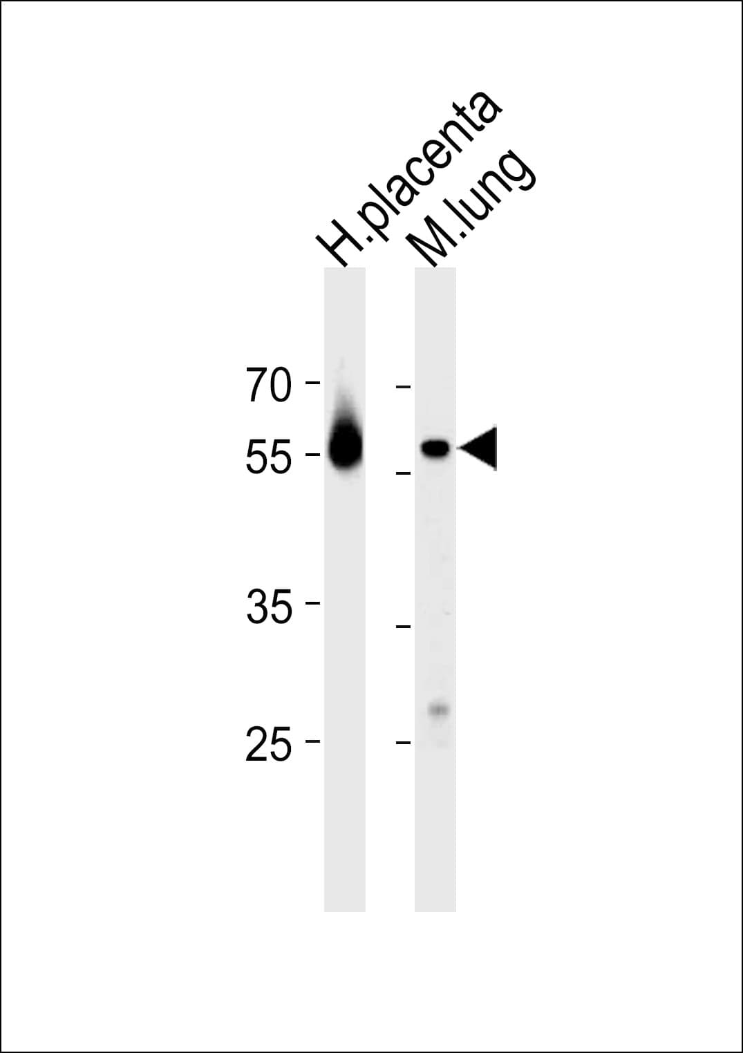 CREB3L2 / BBF2H7 Antibody (aa490-517)