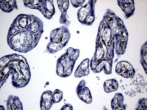 Monoclonal Mouse anti-Human NES / Nestin Antibody (clone OTI3B12, aa99-349, IHC, WB)