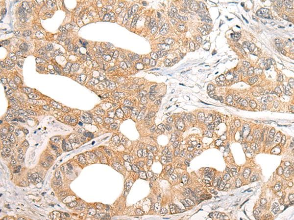 Polyclonal Rabbit anti-Human SNX6 Antibody (IHC)