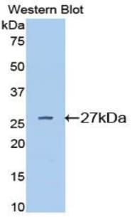 CD71 / Transferrin Receptor Antibody (aa572-757, APC)