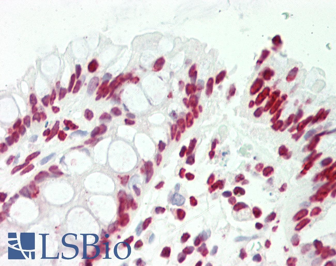 IHC-plus™ Polyclonal Rabbit anti-Human CCNL2 / Cyclin L2 Antibody (aa338-366, IHC, WB)