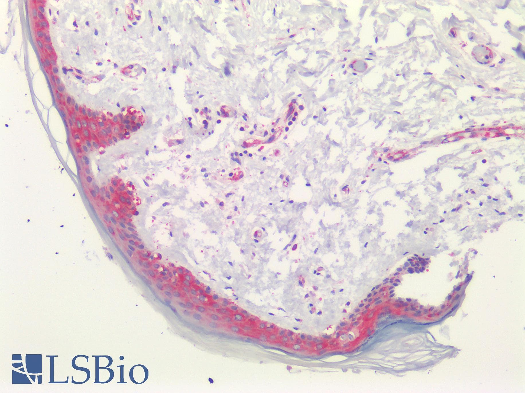 IHC-plus™ Polyclonal Rabbit anti-Human PGAP1 Antibody (N-Terminus, IHC, IF, WB)