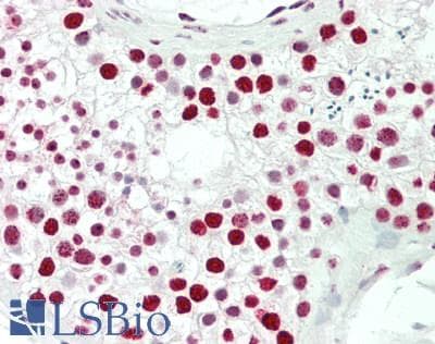 IHC-plus™ PELP1 Antibody (aa1000-1050)