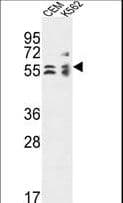 Polyclonal Rabbit anti-Human TCBE / KCS / HRD Antibody (aa364-392, WB)