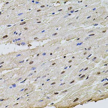 SET / TAF-I Antibody