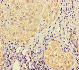 LHFPL1 Antibody