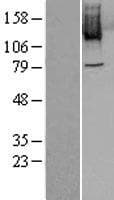 PLK4 / SAK Protein (Over-Expression Lysate Myc-DDK (Flag))