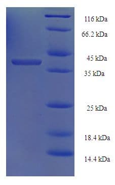 Saccharomyces cerevisiae RAD52 Protein (Recombinant His-SUMO)