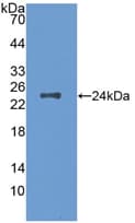 Mouse CSF1 / MCSF Protein (Recombinant His, N-Terminal)