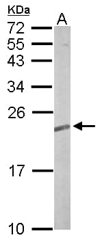 TC21 / RRAS2 Antibody (aa1-204)