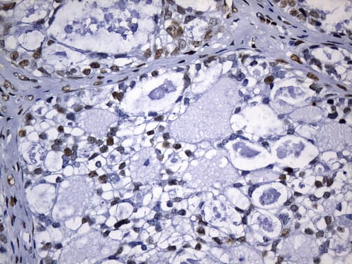 TLE1 / TLE 1 Antibody (aa180-460, clone UMAB253, Carrier-free)