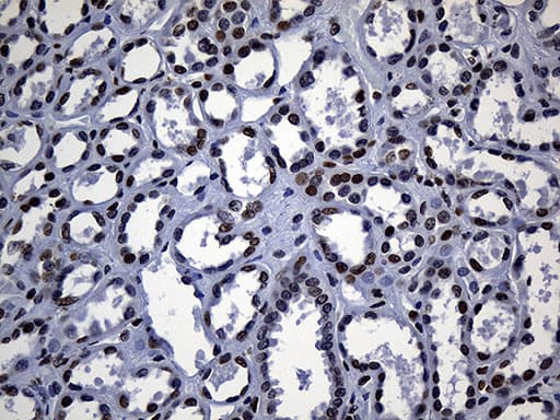 ALOX5 / 5-LOX Antibody (aa18-364, clone OTI1A1)