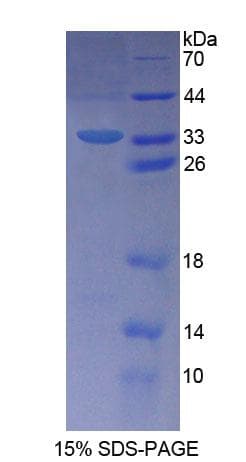 Human SLFN12L Protein (Recombinant His-T7)