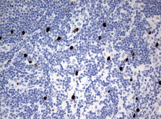 PBX1 Antibody (clone UMAB110)