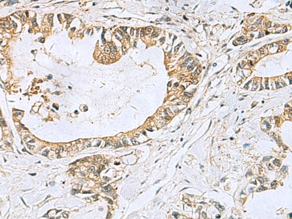 Polyclonal Rabbit anti-Human TUBD1 / Tubulin Delta Antibody (IHC, WB)