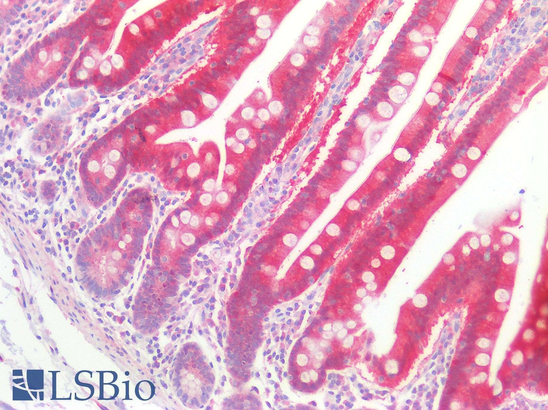 LGALS3 / Galectin 3 Antibody (aa2-264)