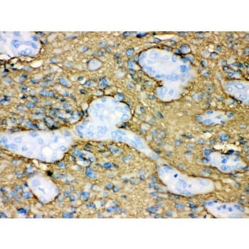 AQP4 / Aquaporin 4 Antibody (aa295-323)