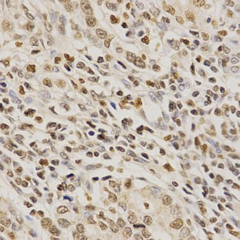 Polyclonal Rabbit anti-Human PDE4D Antibody (IHC, WB)